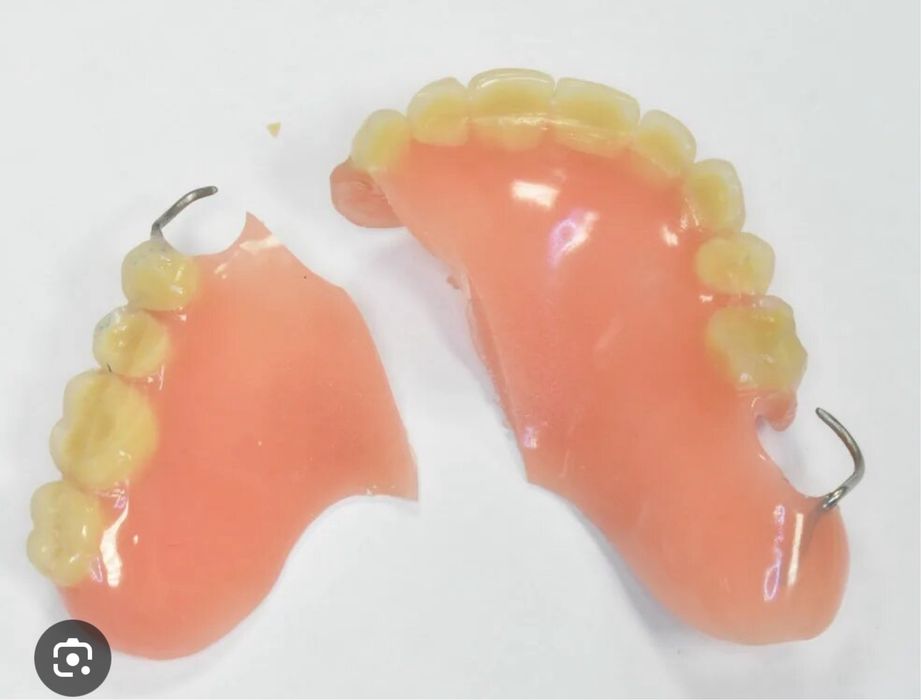 Протез ремонт пачинка
