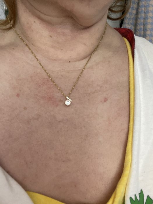 Lant aur cu pandativ zirconiu