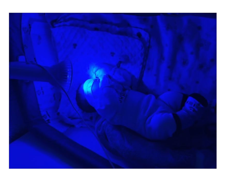 Фотолампа от желтушки