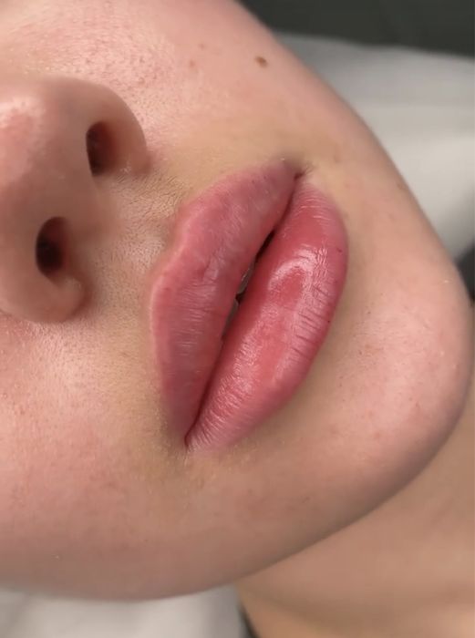 Увелечение губ 700000 ,а так же на все процедуры скидки