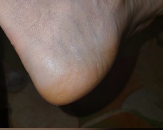 Продам крем-воск от трещин