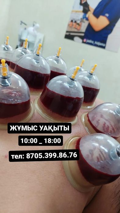Хиджама,шертпе Шымкент!!!