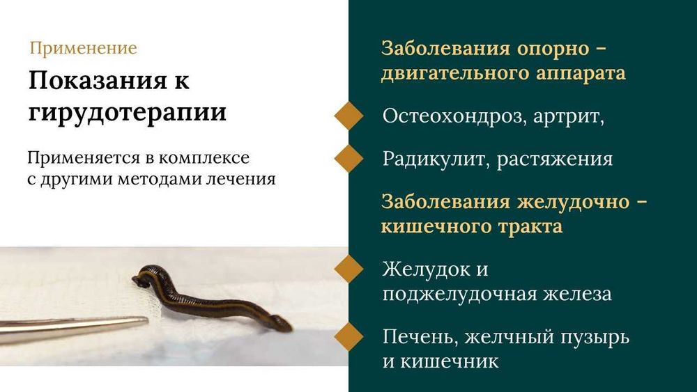 Лечение медицинскими пиявками (гирудотерапия)