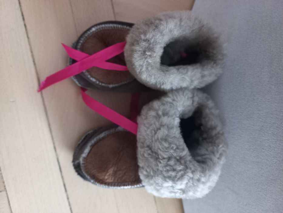 Botosei piele pentru bebe 1 an