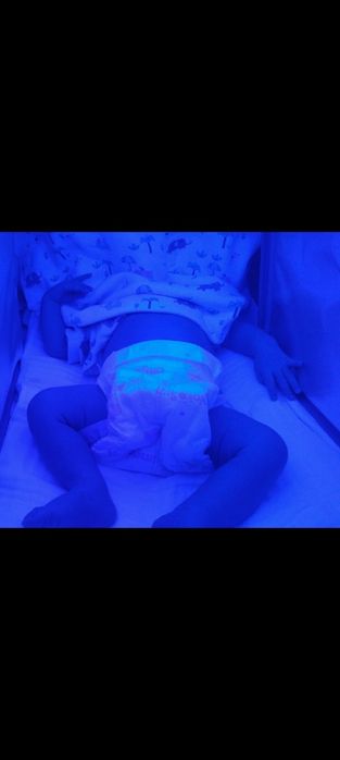 Фотолампа (лампа) от желтухи  для новорожденных.  1500 тг в сутки