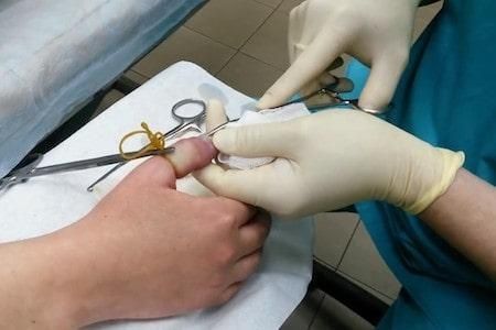 Врач-хирург на выезд