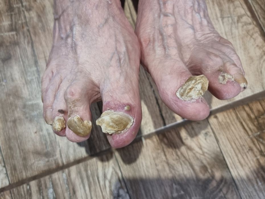 Модул " Медицински педикюр "