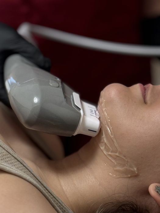 Remodelare cu ultrasunet - LipoSlim & HIFU