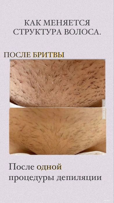 Шугаринг для милых дам