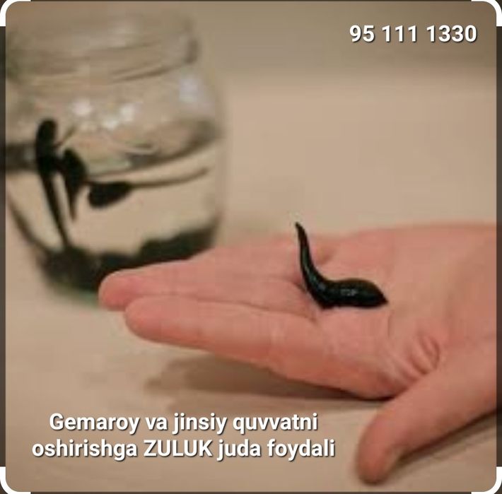 Xijoma va zukuk va hijoma хиджама