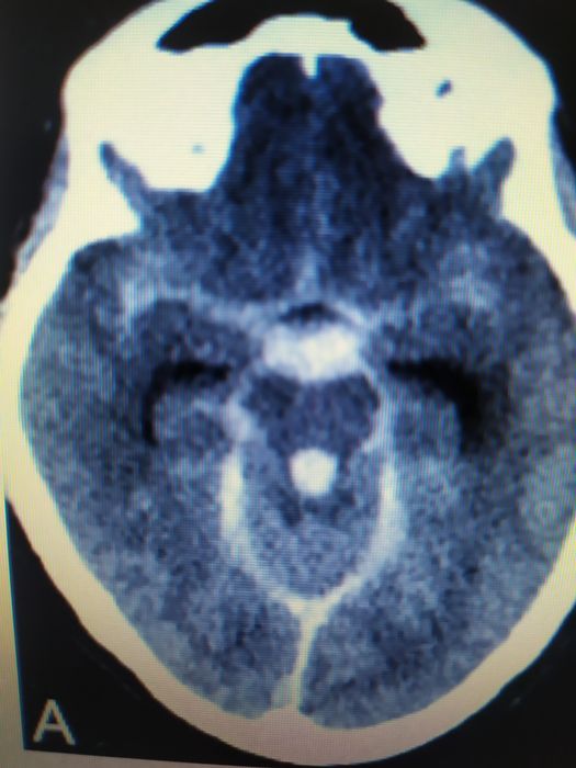 Мскт головного мозга