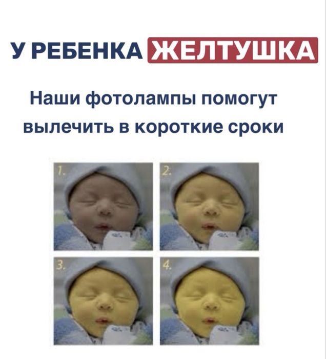 Лампа от желтушки АКЦИЯ не 2000 а 1500тг за один день.