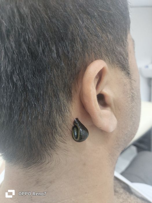 тиббий зулуклар гирудотерапия