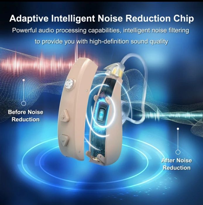 Слуховой аппарат Ric, OE