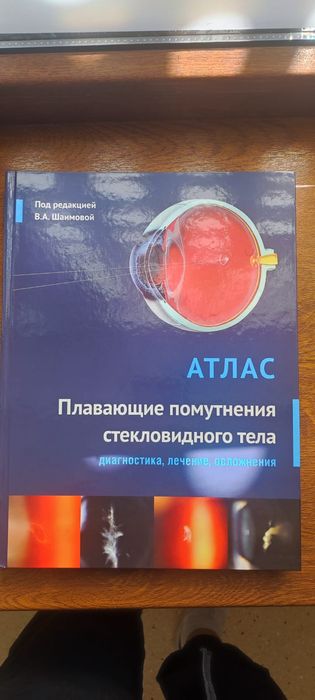 Книги Атласы по Офтальмологии