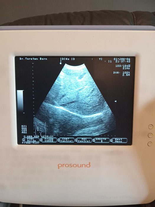 Ecograf portabil ALOKA 2 sonde