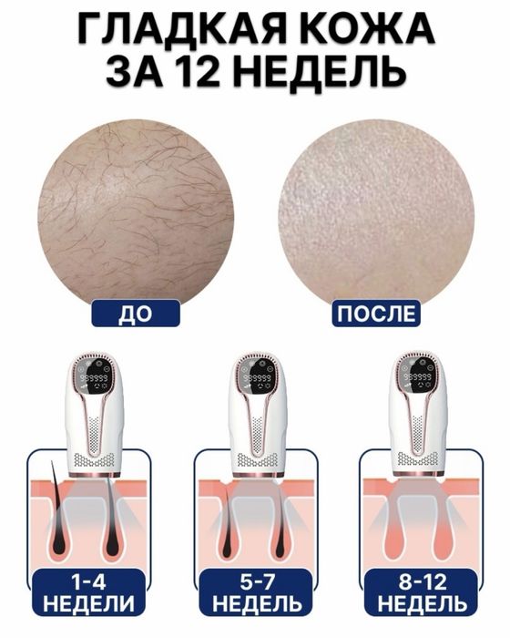 Фото эпилятор продается!!!