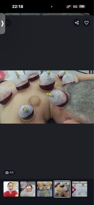 Пиявки Астана - Гирудотерапия