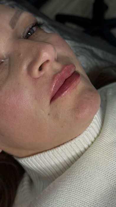 Нужны модели на увеличение губ