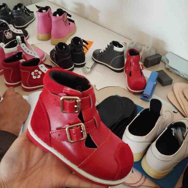 Zakasga ortopedik oyoq kiyimlar tayorlaymiz