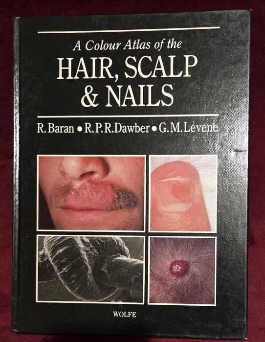 A Colour Atlas of the Hair, Scalp and Nails