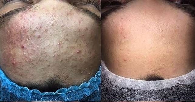 Услуги косметолога для мужчин и женщин