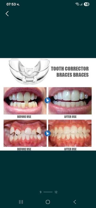 Ортодонтски коректор,шини,алайнер на зъби брекети зъбен фиксатор
Невид