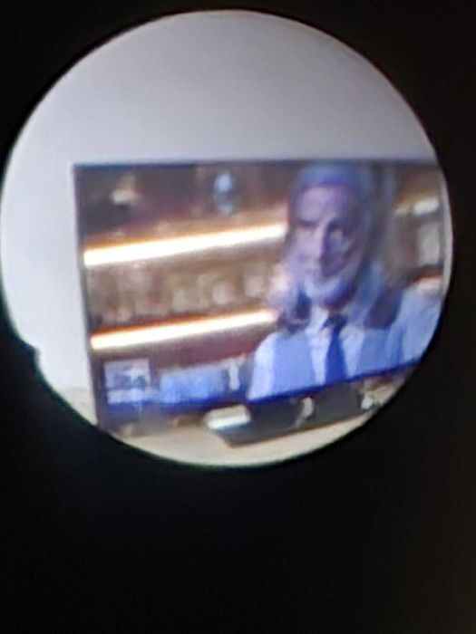 Endoscop sinuscopie ORL 0 grade