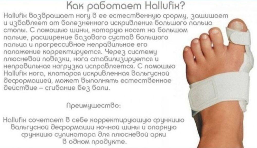 Hallufix Фиксатор-корректор для начальной стадии деформации