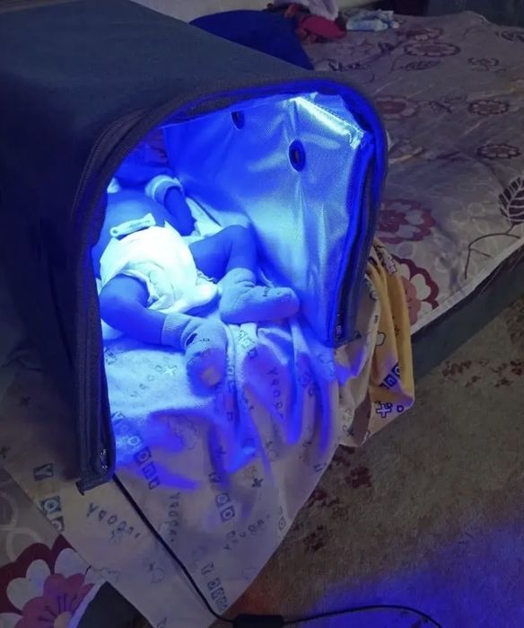 Фотолампа Зачаганск