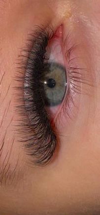 Gene de vis naturale