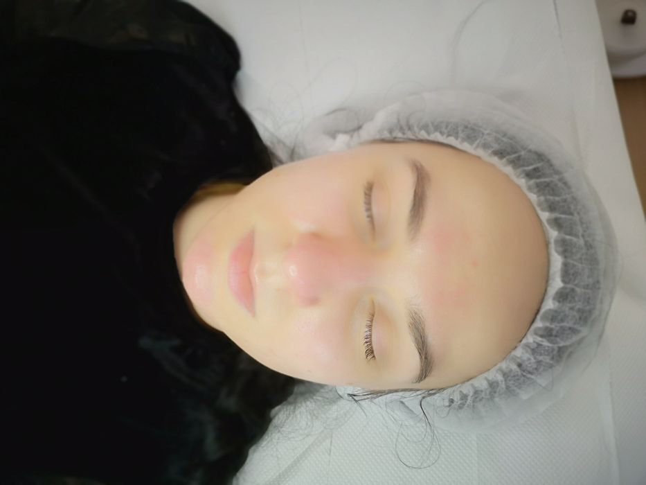HydraFacial profesional – curățare profundă și hidratare intensă