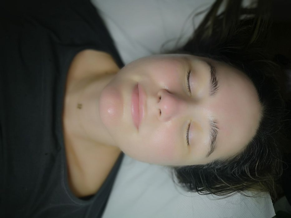 HydraFacial profesional – curățare profundă și hidratare intensă