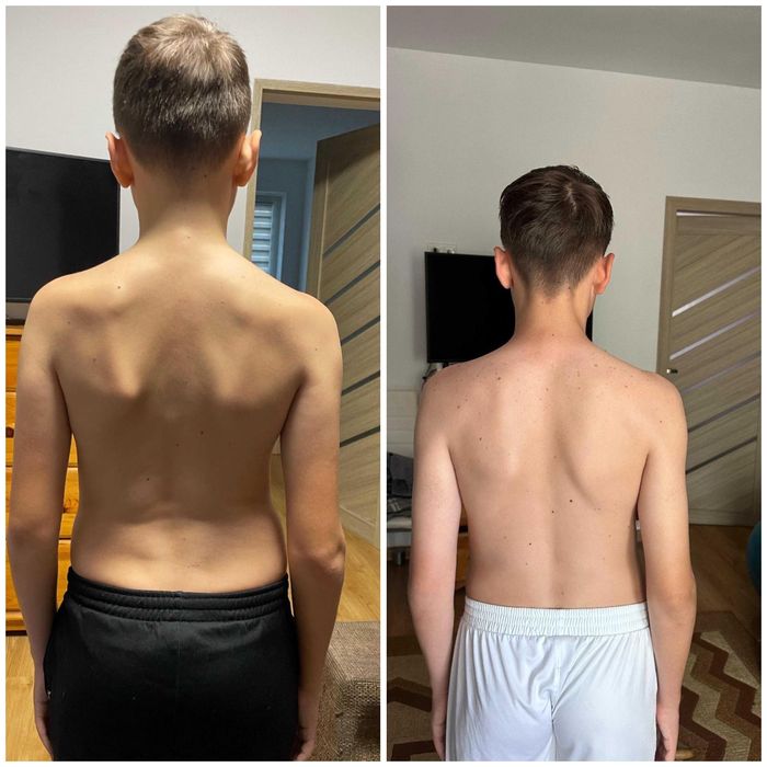 Kinetoterapie la Domiciliu