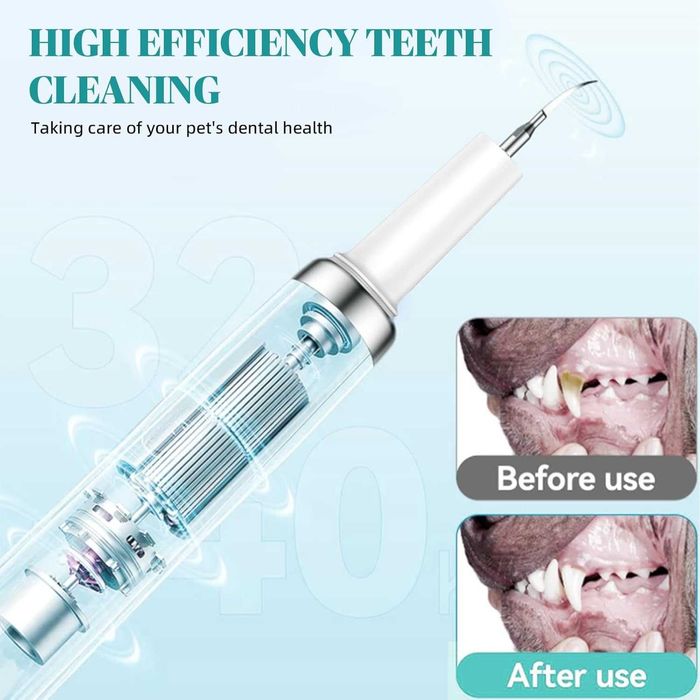 Hauser Комплект за почистване на зъби от зъбен камък и петна, 2 в 1