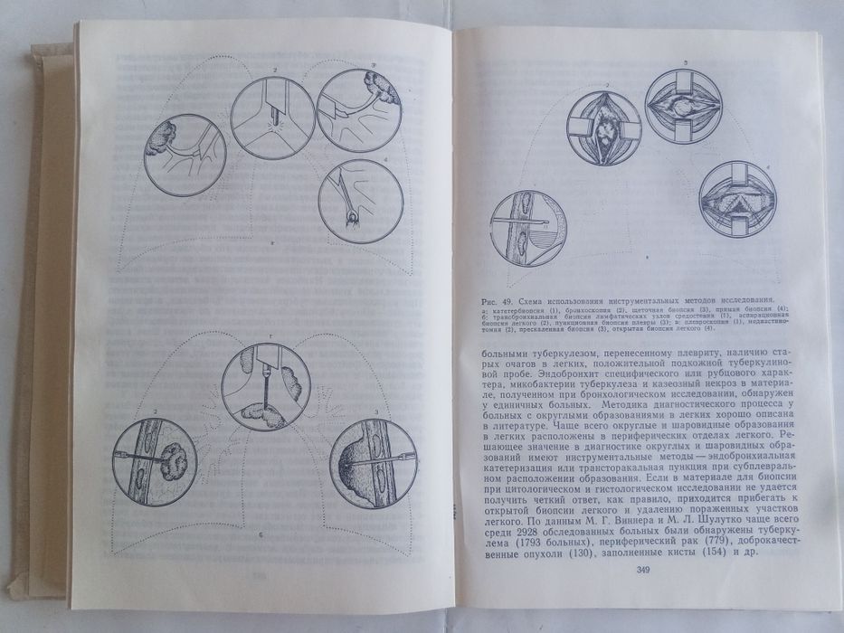 Китоб сотилади упка органи хакида
