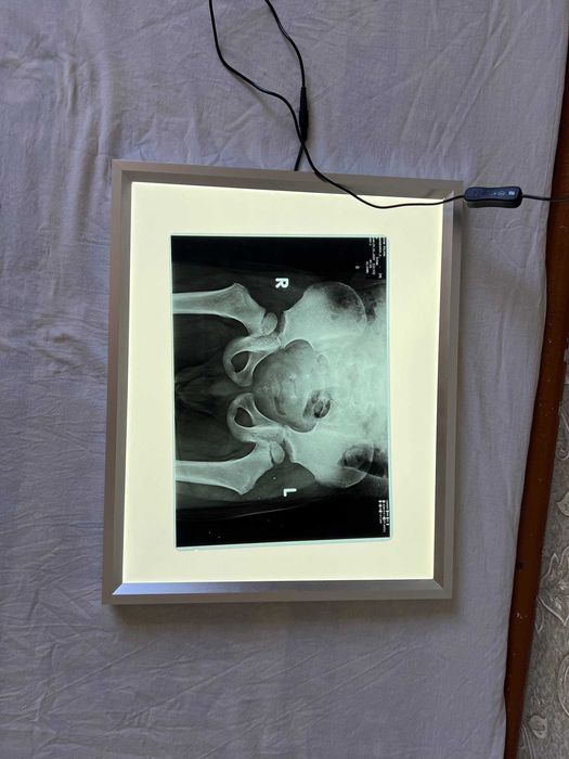 !Новый! Медицинский негатоскоп Nеgаtoskop rentgen doska рентген доска