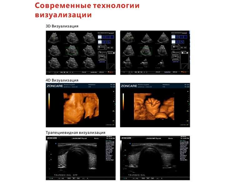 УЗИ-сканер (цифровой стационарный Zoncare-Q7)