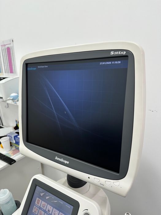 Продам УЗИ аппарат