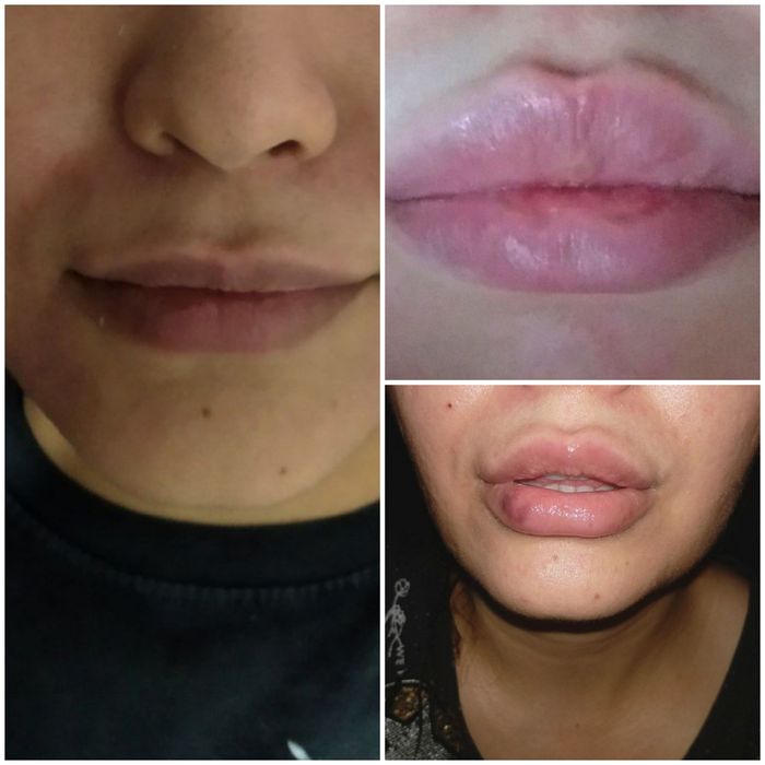 Botox v Tashkente,Kosmetolog