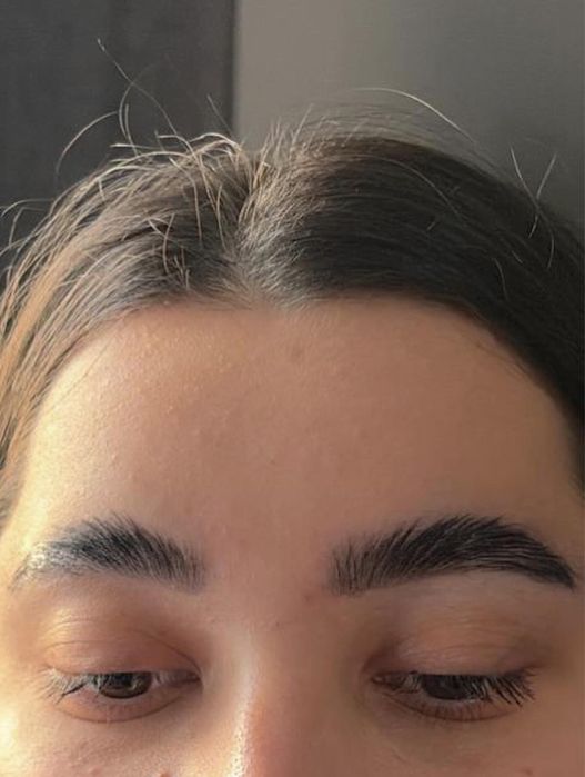 Laminare sprancene /gene