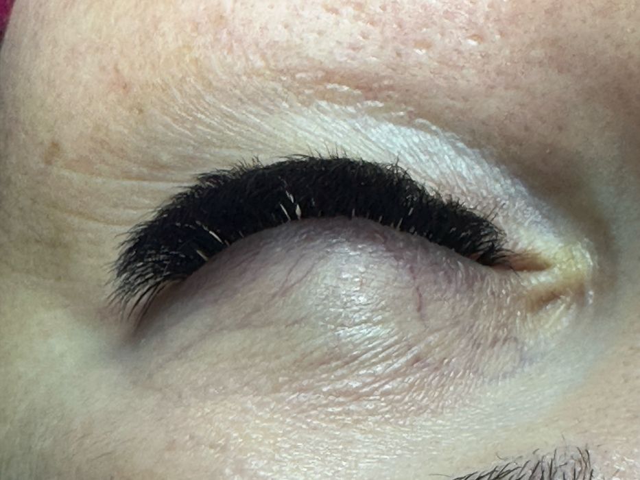 Extensii de gene- Satu Mare