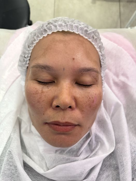 ПРОДАМ профессиональный   лазерный аппарат