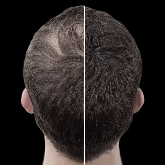 Toppik hair fiber топик загуститель для волос sochni to'ldirish uchun