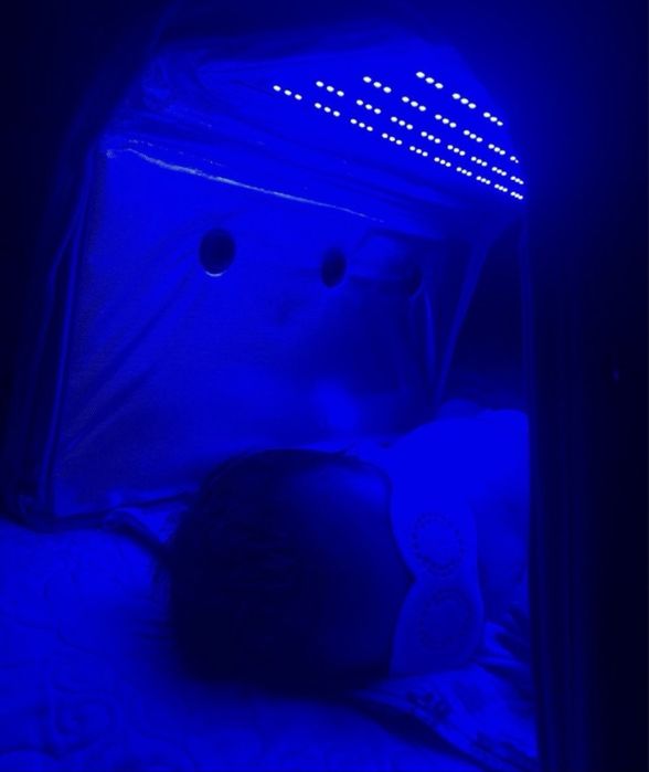 Фотолампа от желтушки