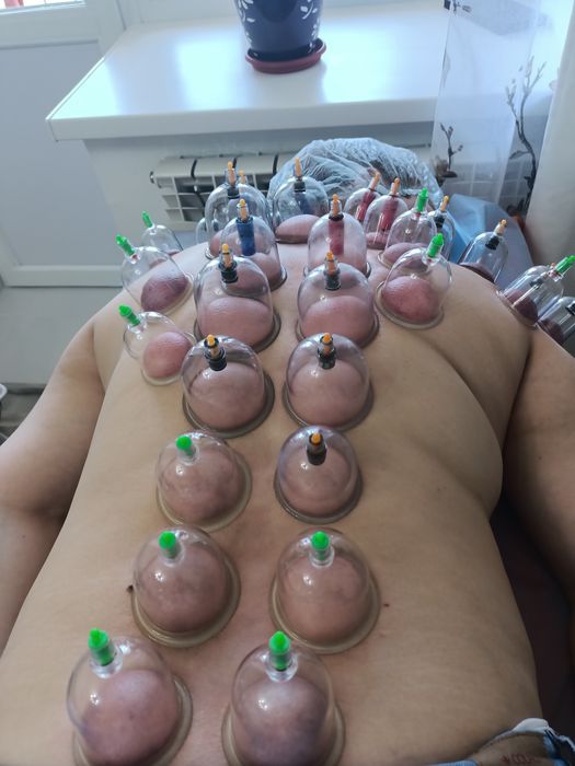 Народный метод лечения.