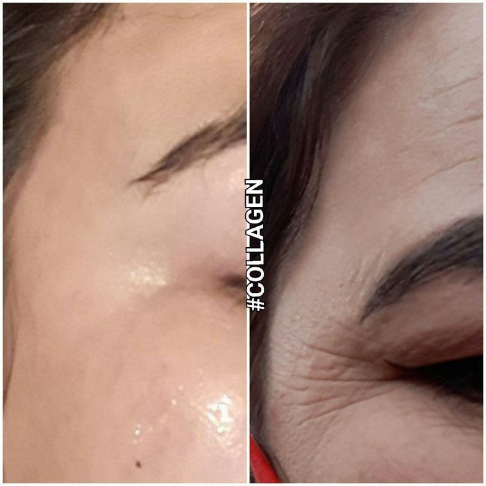 Collagen eliksir molodosti