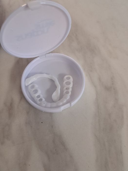 зъбни фасети за закриване на изгубени зъби