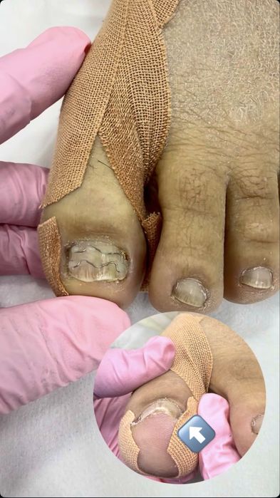 Маникюр и педикюр