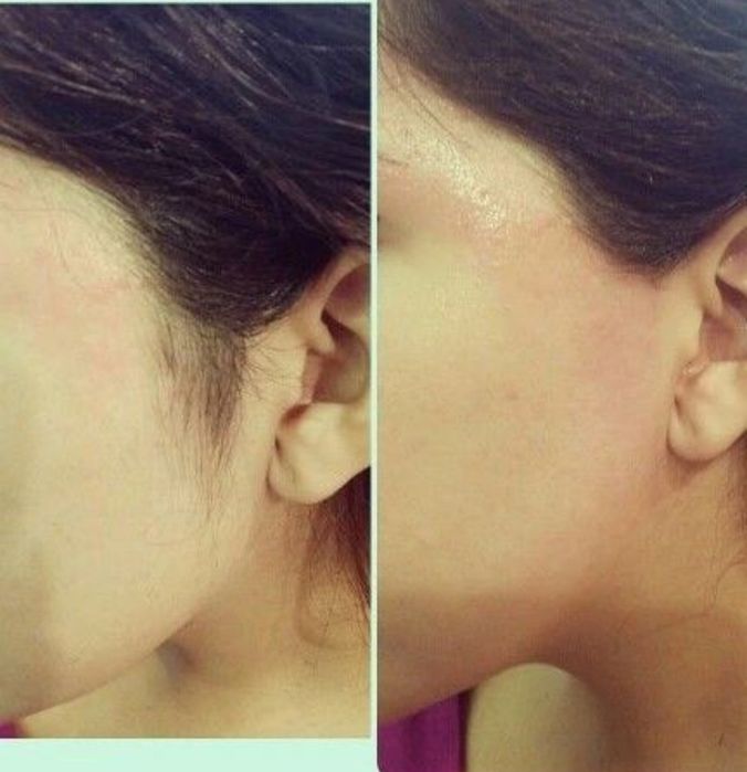 Женская депиляция очень аккуратно и профессионально
